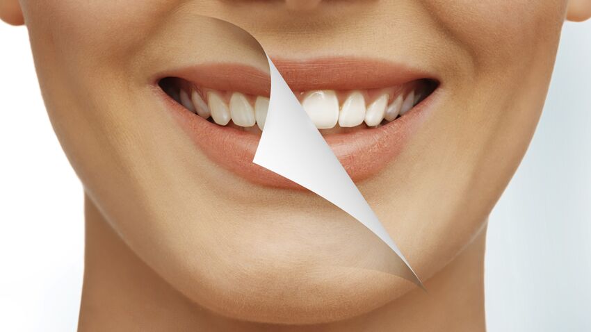 taches-sur-les-dents.jpeg taches-sur-les-dents.jpeg