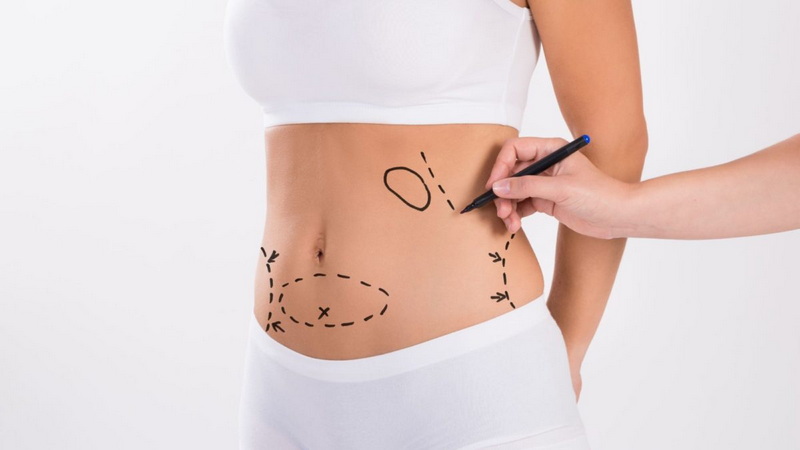 Body-Contouring-Clinic.jpg