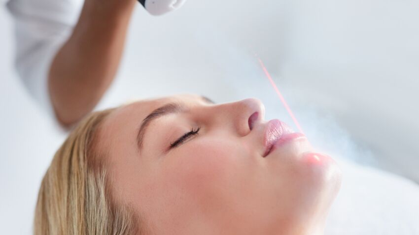 Лазерная косметология. Золотой стандарт acne-une-nouvelle-technique-au-laser.jpeg