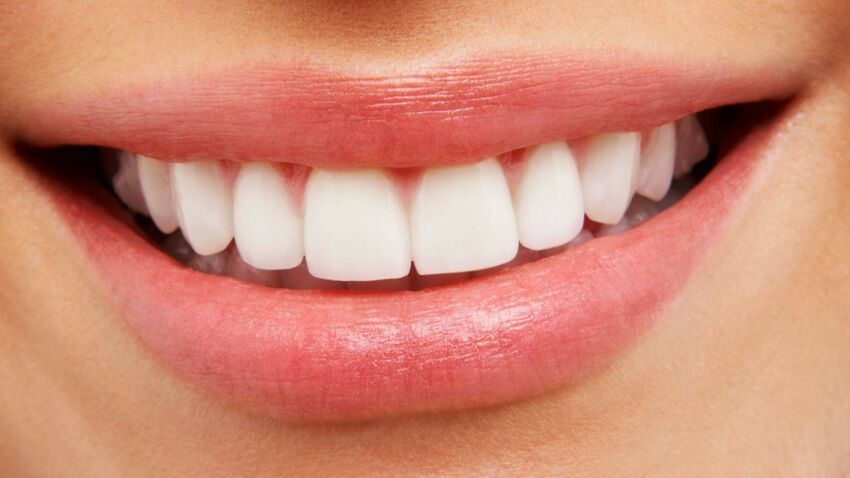 Виниры comment-proteger-l-email-des-dents.jpeg